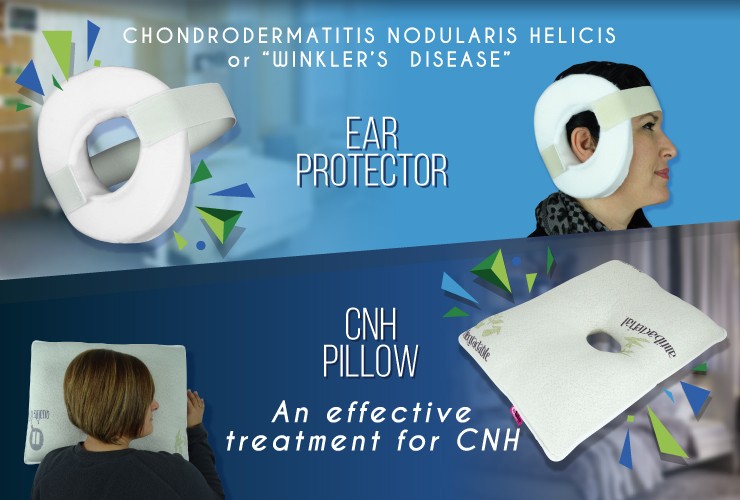 chondrodermatitis nodularis helicis offers